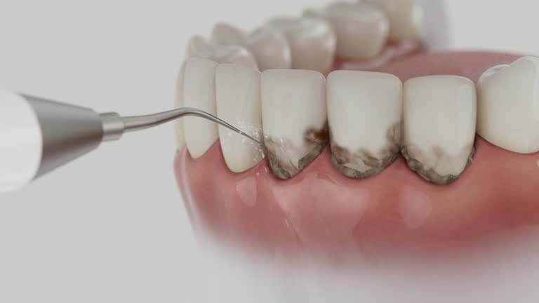 Reliable Dental contractor in Vine Hill, CA by Smile Center Dentistry